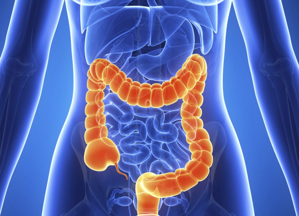 Cáncer de colon: Mitos a desterrar y consejos a seguir