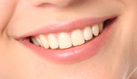 Sonrisa blanca contagiosa y feliz